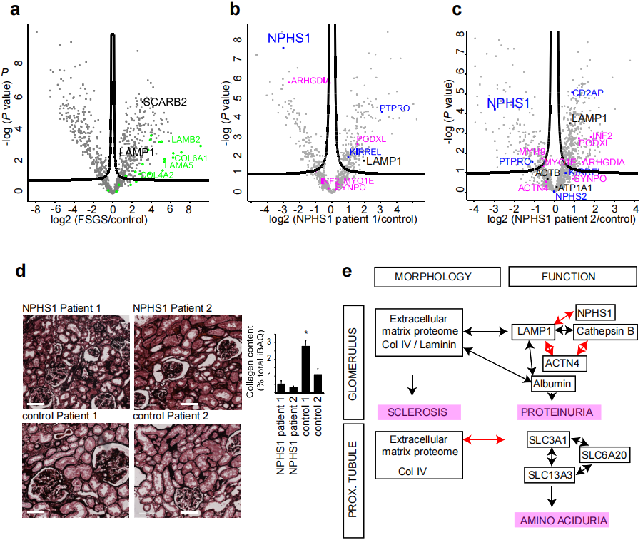 揭秘蛋白尿性肾病 | SP3技术揭示单个肾单位病理机制！(图6)