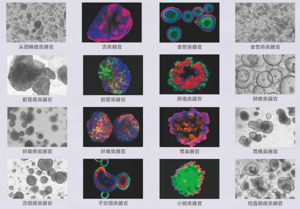 类器官代谢组学-百趣生物非靶标代谢组学