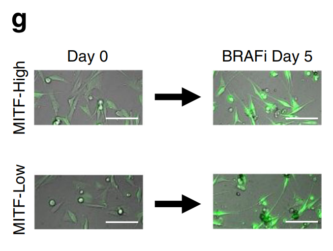 对BRAFi治疗5天的细胞用单细胞延时显微镜分析MITF 活性