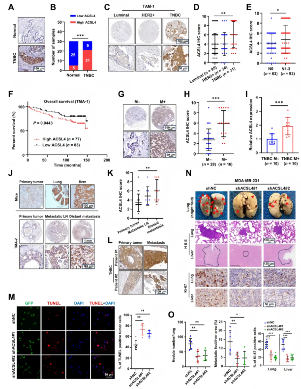 Cancer Res. (IF=16.6)｜重庆医科大学研究团队：ACSL4驱动磷脂重塑解析TNBC转移，点亮靶向联合化疗新路径(图4)