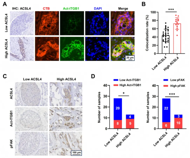 Cancer Res. (IF=16.6)｜重庆医科大学研究团队：ACSL4驱动磷脂重塑解析TNBC转移，点亮靶向联合化疗新路径(图8)