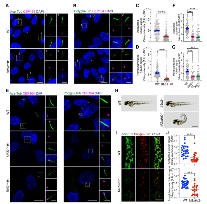 IF=13.6!上海交通大学曹木青老师团队新突破:B9复合体双功能解析,揭示纤毛病(JBTS/MKS)的分子分水岭!(图3) IF=13.6!上海交通大学曹木青老师团队新突破:B9复合体双功能解析,揭示纤毛病(JBTS/MKS)的分子分水岭!(图3)