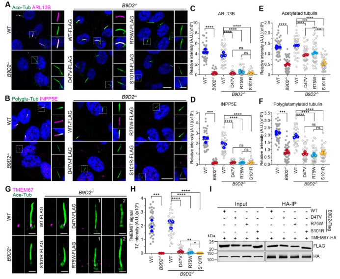 IF=13.6!上海交通大学曹木青老师团队新突破:B9复合体双功能解析,揭示纤毛病(JBTS/MKS)的分子分水岭!(图9) IF=13.6!上海交通大学曹木青老师团队新突破:B9复合体双功能解析,揭示纤毛病(JBTS/MKS)的分子分水岭!(图9)