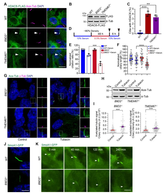 IF=13.6!上海交通大学曹木青老师团队新突破:B9复合体双功能解析,揭示纤毛病(JBTS/MKS)的分子分水岭!(图5) IF=13.6!上海交通大学曹木青老师团队新突破:B9复合体双功能解析,揭示纤毛病(JBTS/MKS)的分子分水岭!(图5)