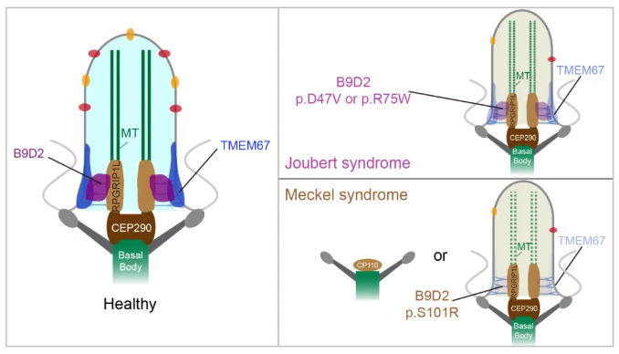 IF=13.6!上海交通大学曹木青老师团队新突破:B9复合体双功能解析,揭示纤毛病(JBTS/MKS)的分子分水岭!(图2) IF=13.6!上海交通大学曹木青老师团队新突破:B9复合体双功能解析,揭示纤毛病(JBTS/MKS)的分子分水岭!(图2)