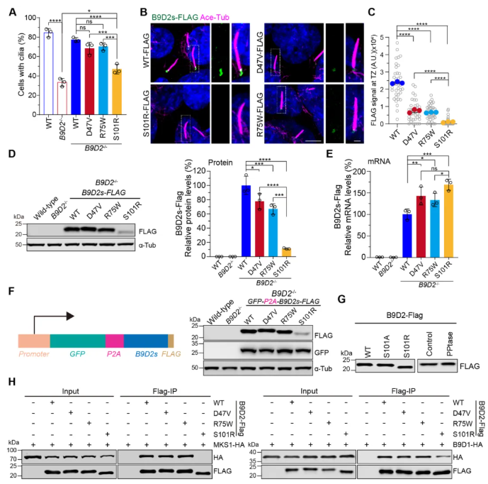 IF=13.6!上海交通大学曹木青老师团队新突破:B9复合体双功能解析,揭示纤毛病(JBTS/MKS)的分子分水岭!(图8) IF=13.6!上海交通大学曹木青老师团队新突破:B9复合体双功能解析,揭示纤毛病(JBTS/MKS)的分子分水岭!(图8)