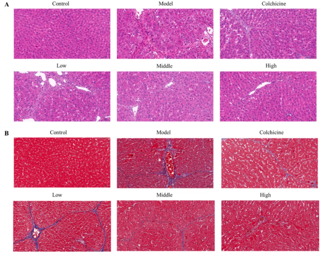 J Ethnopharmacol.|甘肃中医药大学张志红老师团队破解经典药对奥秘,精准阐释当归-白芍药对抗肝纤维化作用机制(图4) J Ethnopharmacol.|甘肃中医药大学张志红老师团队破解经典药对奥秘,精准阐释当归-白芍药对抗肝纤维化作用机制(图4)