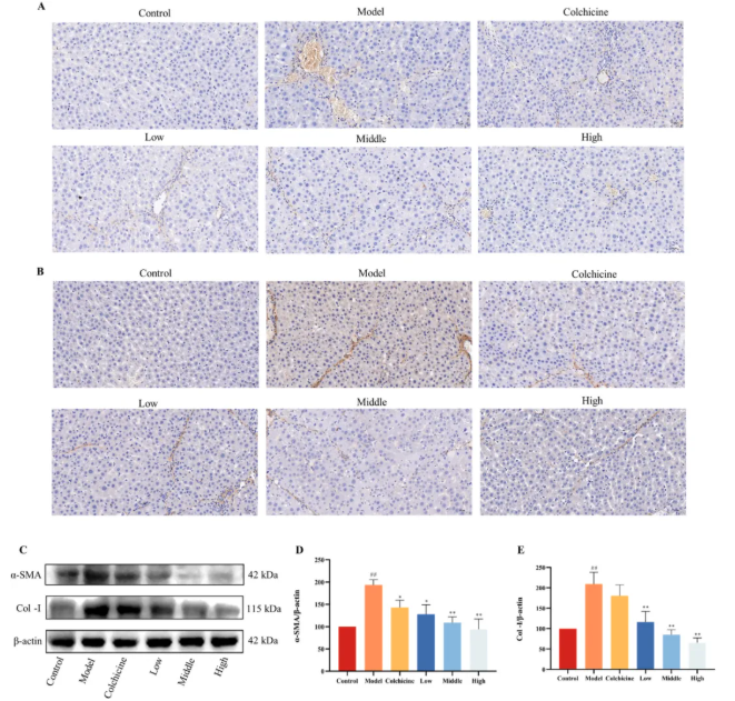 J Ethnopharmacol.|甘肃中医药大学张志红老师团队破解经典药对奥秘,精准阐释当归-白芍药对抗肝纤维化作用机制(图5) J Ethnopharmacol.|甘肃中医药大学张志红老师团队破解经典药对奥秘,精准阐释当归-白芍药对抗肝纤维化作用机制(图5)