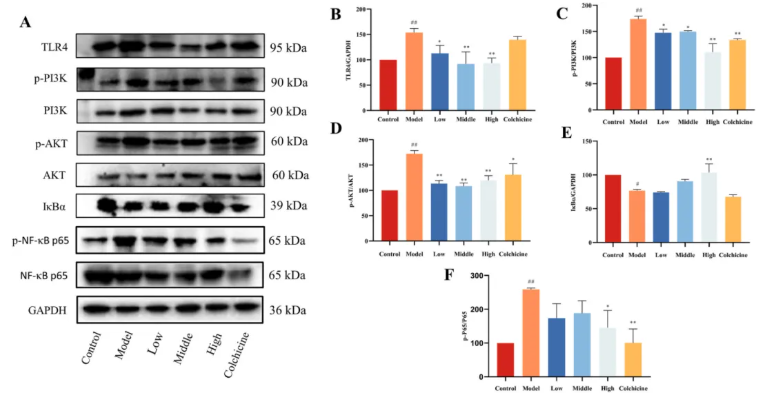J Ethnopharmacol.|甘肃中医药大学张志红老师团队破解经典药对奥秘,精准阐释当归-白芍药对抗肝纤维化作用机制(图13) J Ethnopharmacol.|甘肃中医药大学张志红老师团队破解经典药对奥秘,精准阐释当归-白芍药对抗肝纤维化作用机制(图13)