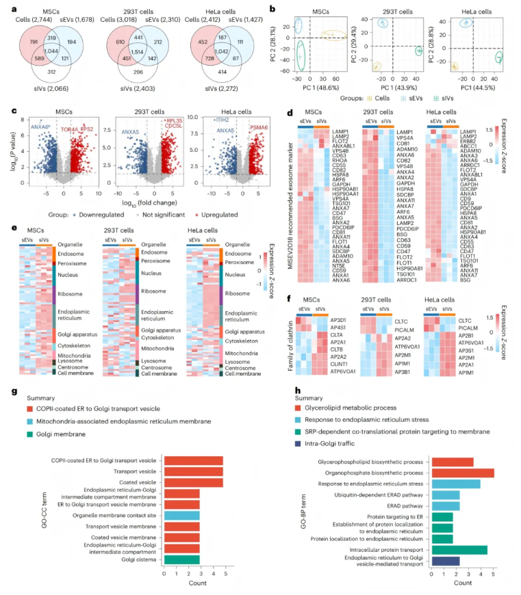 nature子刊(IF=26.6)|小小囊泡竟有大作用，天津医大眼科医院实现网膜保护+药物递送双突破(图4)