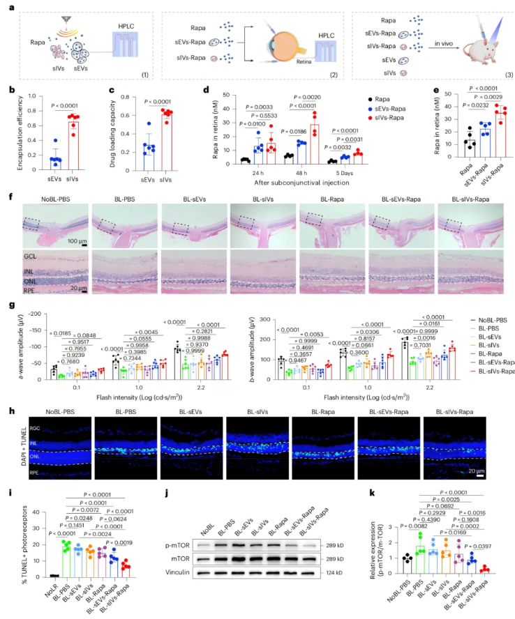 nature子刊(IF=26.6)|小小囊泡竟有大作用，天津医大眼科医院实现网膜保护+药物递送双突破(图9)