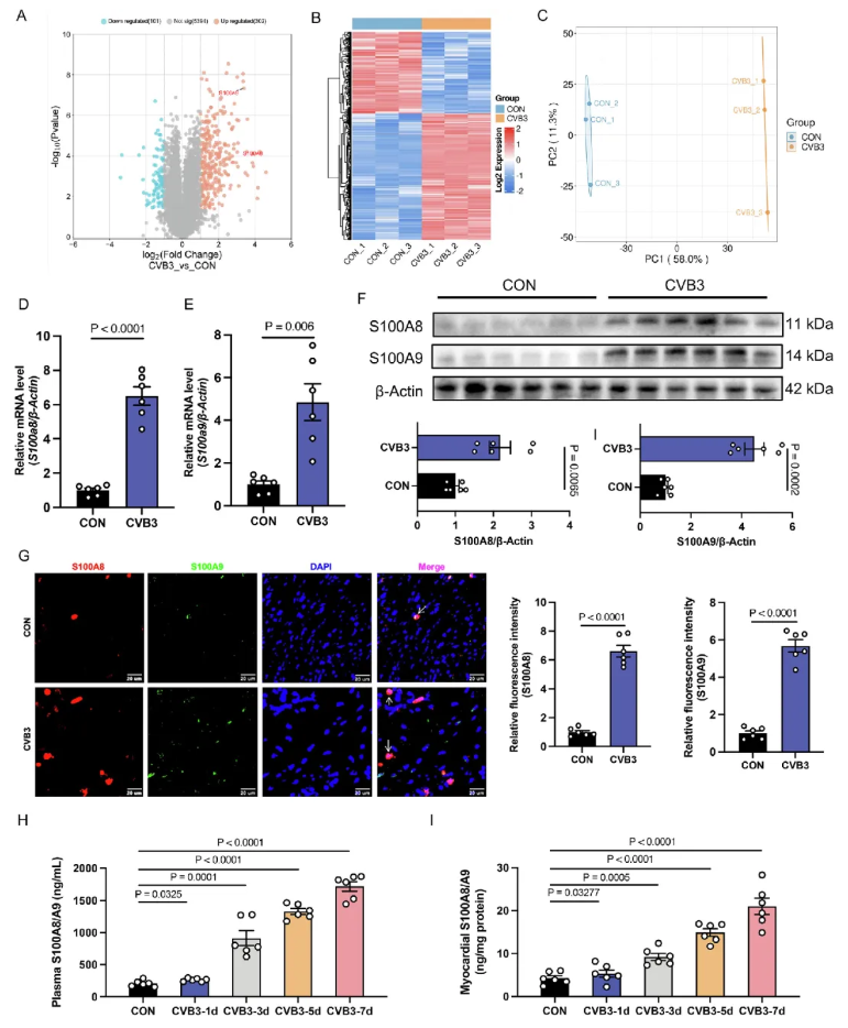 J.Adv.Res.(IF=13)|血浆蛋白质组学赋能：暴发性心肌炎精准诊断与靶向治疗新突破(图6)