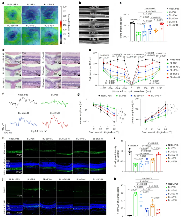 nature子刊(IF=26.6)|小小囊泡竟有大作用，天津医大眼科医院实现网膜保护+药物递送双突破(图6)