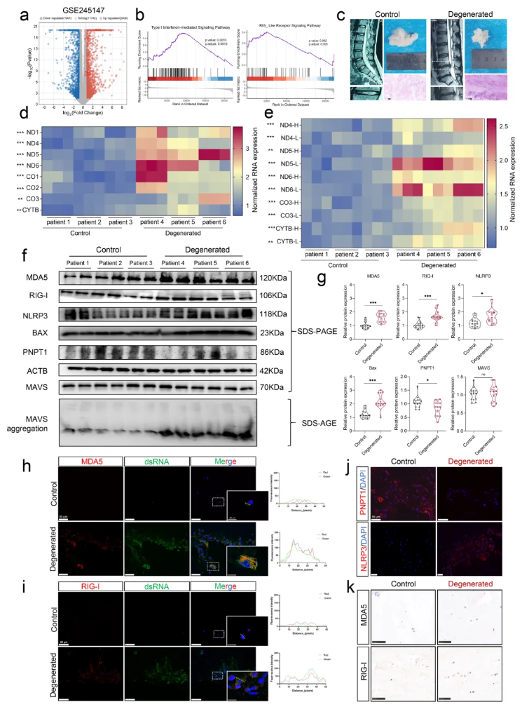CCS(IF=8.9)|华中科技大学杨操教授团队：牛磺酸通过增强线粒体自噬，抑制mtdsRNA介导的髓核细胞焦亡(图3)
