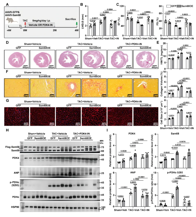 Circulation(IF=38.7)|南科大医学院覃刚健团队重大发现：靶向Sam68解锁心肌葡萄糖氧化，开启心衰代谢干预新策略(图7)