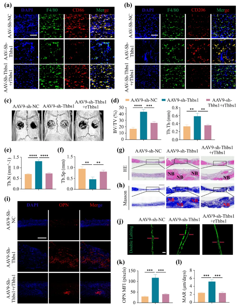 Aging Cell(IF=7.7)|福建医科大学陈江教授团队：揭秘衰老骨髓微环境恶性循环！Thbs1靶向破解老年骨再生难题(图10)