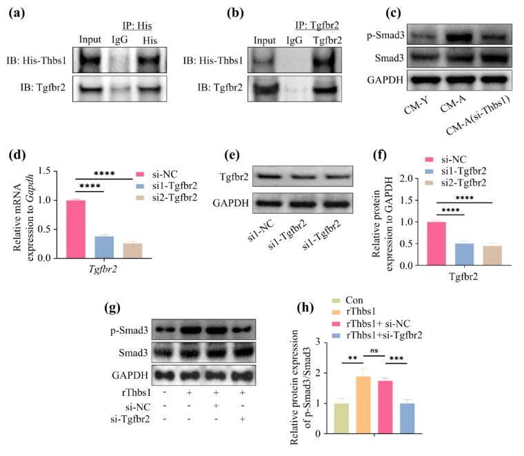 Aging Cell(IF=7.7)|福建医科大学陈江教授团队：揭秘衰老骨髓微环境恶性循环！Thbs1靶向破解老年骨再生难题(图6)