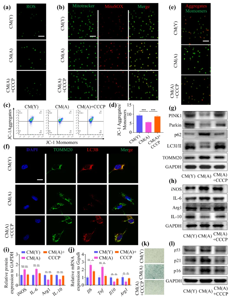 Aging Cell(IF=7.7)|福建医科大学陈江教授团队：揭秘衰老骨髓微环境恶性循环！Thbs1靶向破解老年骨再生难题(图4)
