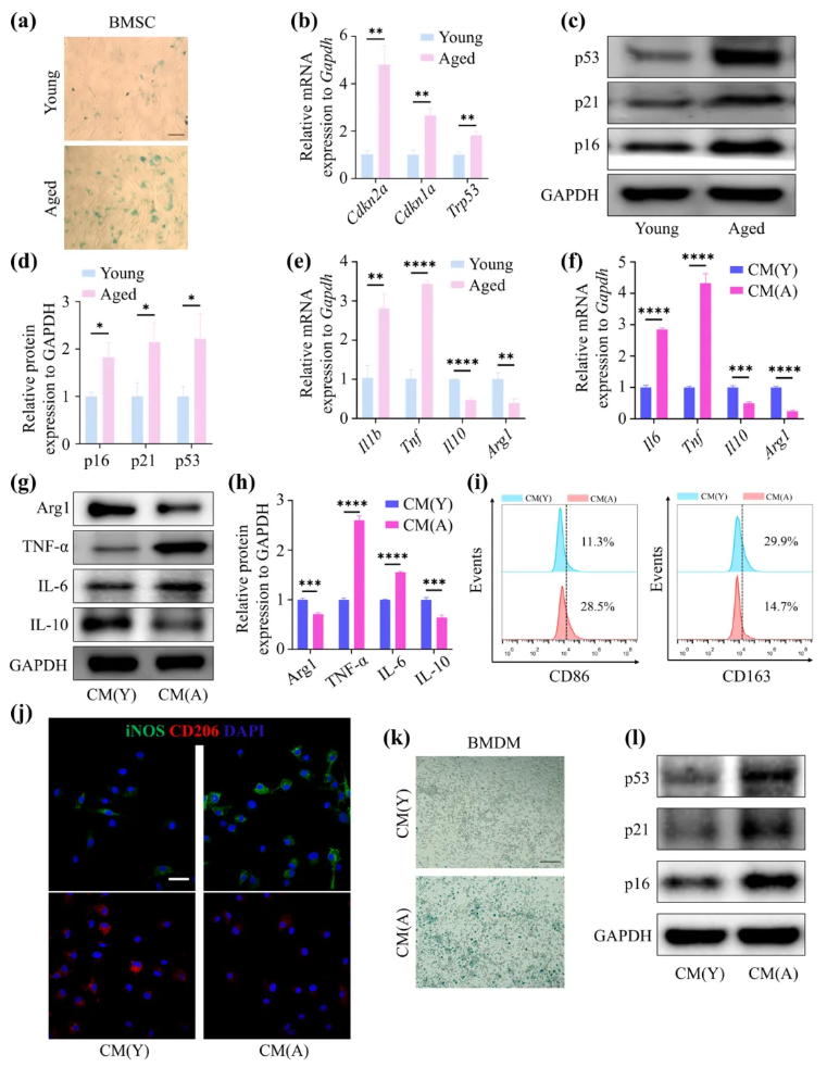 Aging Cell(IF=7.7)|福建医科大学陈江教授团队：揭秘衰老骨髓微环境恶性循环！Thbs1靶向破解老年骨再生难题(图2)